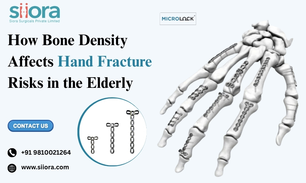 How Bone Density Affects Hand Fracture Risks in the Elderly?