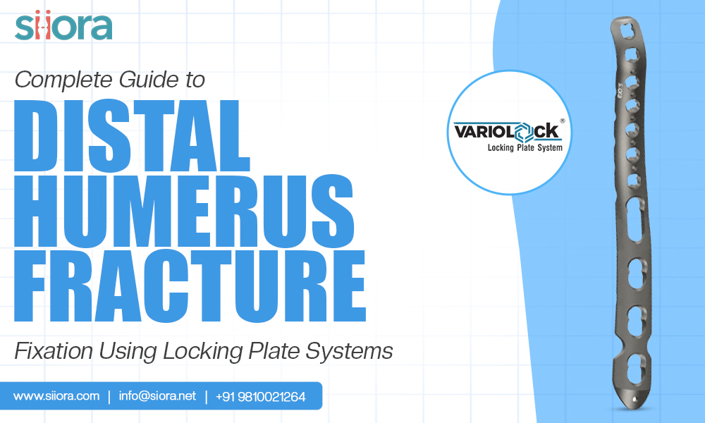 Complete Guide to Distal Humerus Fracture Fixation Using Locking Plate&nbsp;Systems